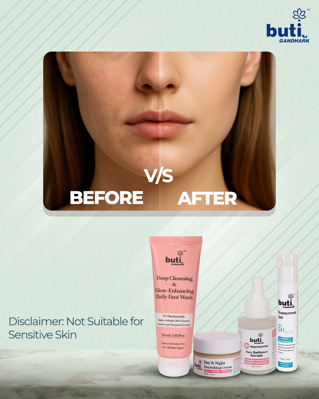 Dull, Uneven Skin Tone